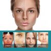 EELHOE Spot Cream Hydrates And Moisturizes Skin To Lighten Spots, Acne , Brightening And Rejuvenating Skin Beauty Cream